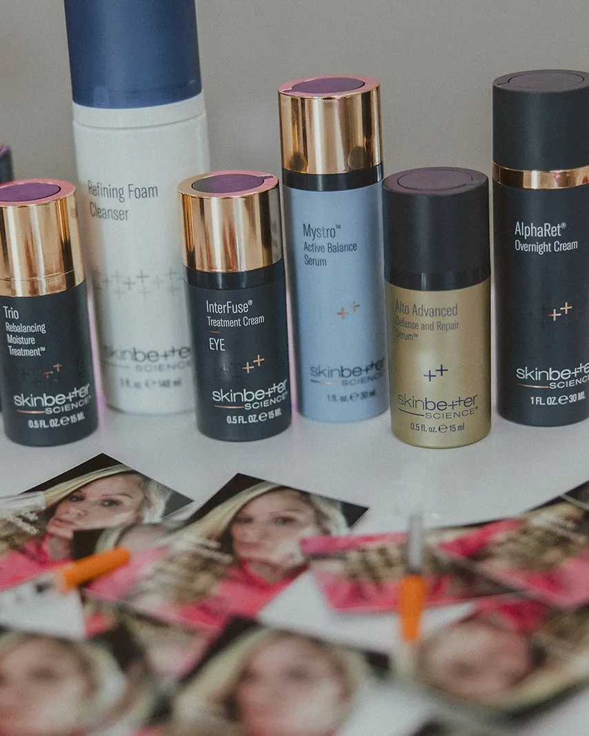 Skinbetter Science products standing on a table above a spread of Amy's business cards.